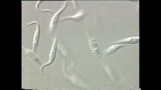 Trypanosoma [upl. by Eatnuahs228]