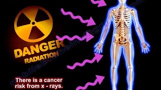 Radiation Exposure Radiation safety Everything You Need To Know  Dr Nabil Ebraheim [upl. by Fox473]