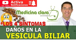 👨‍⚕️👀 LOS 4 SINTOMAS ALARMA VESÍCULA BILIAR DAÑADA PIEDRAS  Medicina Clara [upl. by Rapp]