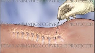 Split vs Splitless Injection [upl. by Adaminah]