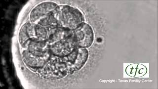 Embryo Folding Amniotic Cavity amp Yolk Sac  Animated Embryology [upl. by Eitnom]