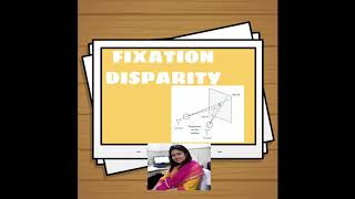 FIXATION DISPARITY  Lecture by Kriti Mitra [upl. by Ocsinarf]