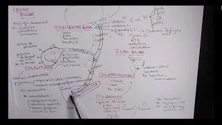 MEJOR EXPLICACIÓN COLELITIASIS COLECISTITIS COLEDOCOLITIASIS COLANGITIS [upl. by Assenar467]