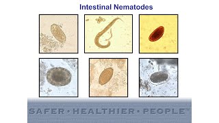 Diagnostic Features of Intestinal Nematodes [upl. by Enillebyam]