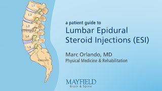 Lumbar Epidural Steroid Injections [upl. by Onofredo]