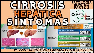 CIRROSIS HEPÁTICA SÍNTOMAS  GuiaMed [upl. by Chainey]