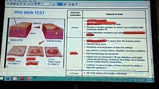 Administering amp Checking a PPD Nursing Skills [upl. by Nivk]