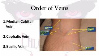 Internal Jugular Vein  Anatomy Tutorial [upl. by Hakeem]