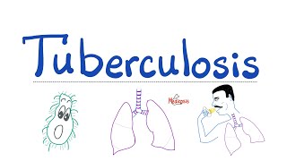 Tuberculosis Screening Guidelines USMLE STEPs 1 2 amp 3 [upl. by Inoliel]