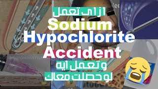 How To Avoid and How To Manage Sodium Hypochlorite Accident [upl. by Nuahsal]