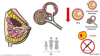 Endovascular Papillary Endothelial Hyperplasia  Pathology mini tutorial [upl. by Tidwell132]