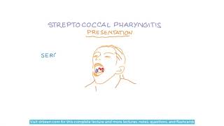 Streptococcus Pyogenes  Diseases and Their Management [upl. by Squire]