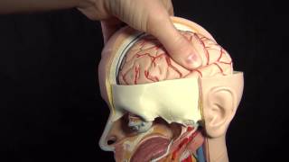 Increased ICP Intracranial Pressure Nursing Care Animation [upl. by Sardella]