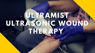 Ultra Mist Ultrasonic Wound Therapy [upl. by Adala567]