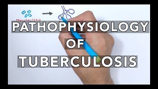 Pathophysiology of Tuberculosis [upl. by Leupold]