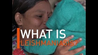 What is Leishmaniasis [upl. by Madson206]