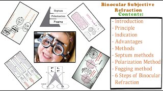 Binocular Subjective Refraction  Full Tutorial [upl. by Atauqal]