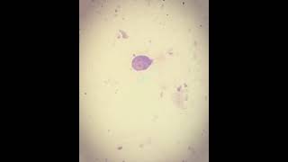 Giardia lamblia por microscopia [upl. by Yentterb]