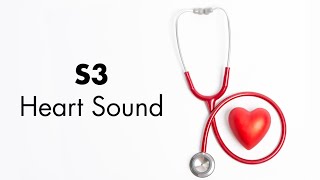 S3 Heart Sound  MEDZCOOL [upl. by Follmer89]