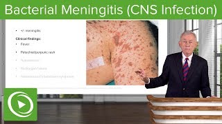 Bacterial Meningitis CNS Infection – Infectious Diseases  Lecturio [upl. by Gautier]