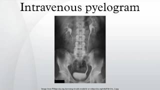 Intravenous pyelogram [upl. by Oderf]