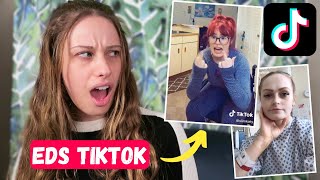 Reacting to EhlersDanlos TikToks [upl. by Seiter831]