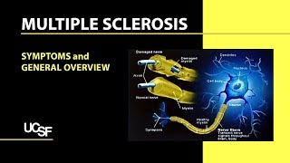 What is Multiple Sclerosis [upl. by Ahsurej710]