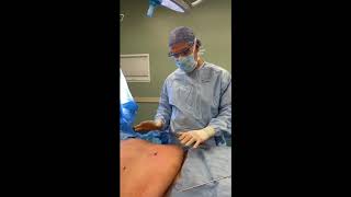 Get Firm Sculpted Arms With Smartlipo™  Dr Sterry Explains [upl. by Doran274]