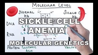 Sickle Cell Anemia A Patients Journey [upl. by Iggie]