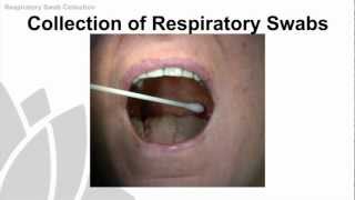 How to Perform Nasal Irrigation After Surgery [upl. by Dronski]