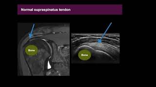 Musculoskeletal MSK Ultrasound Basics [upl. by Korten]