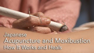 Japanese Acupuncture and Moxibustion How It Works [upl. by Elamaj]