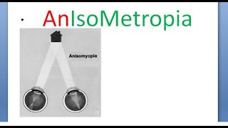 Ophthalmology AnIsoMetropia Simple Compound Mixed AnIsoMyopia AnIsoHyperMetropia AntiMetropia [upl. by Lertram926]