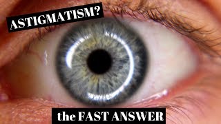 Astigmatism Explained in One Minute [upl. by Amyas]