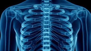 HOW TO READ A CHEST XRAY [upl. by Newmark]