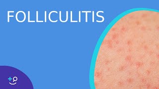 Folliculitis  Daily Dos of Dermatology [upl. by Annaiuq749]