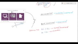 Weber and Rinne Tuning Fork tests for USMLE [upl. by Ijneb]