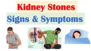 Kidney Disease and Dialysis  Health  Biology  FuseSchool [upl. by Retsbew]