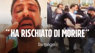 Fabrizio Corona l’avvocato “Ha rischiato di morire Ha 14 punti di sutura” [upl. by Hairas572]