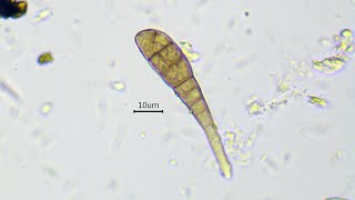 Growing of hyphae and septa formation in Alternaria sp  fast time lapse [upl. by Etnoed]