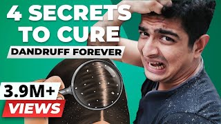 4 SECRET Tips To Remove Dandruff Forever  BeerBiceps Health [upl. by Annwahsal]