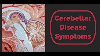 Cerebellar Disease Symptoms [upl. by Ihculo921]