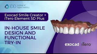 Exocad Smile Creator  iTero Element 5D Plus Inhouse Smile Design and Functional TryIn [upl. by Connelly]