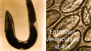 Entrobius vermicularis Pin Worm under microscope at 40 X [upl. by Lester]