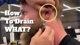 BJJ For Beginners How to Drain Cauliflower Ear [upl. by Cumine]