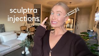 Sculptra Injections What to expect  FAQ [upl. by Dowzall914]