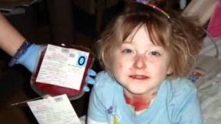 Epidermolysis Bullosa  An Easy Approach  Dermatology Lectures [upl. by Kenzie]