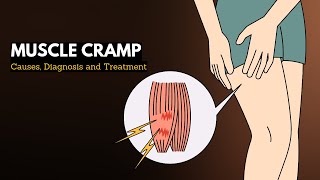 What Causes Period Cramps  How To Manage Period Cramps [upl. by Inglebert]