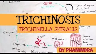 TRICHINOSIS  TRICHINELLA SPIRALIS  STRUCTURE  LIFE CYCLE  SYMPTOMS  BY PHANINDRA GUPTA [upl. by Pressey]