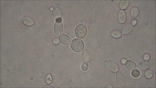 Bakers Yeast under the Microscope [upl. by Ttenyl]